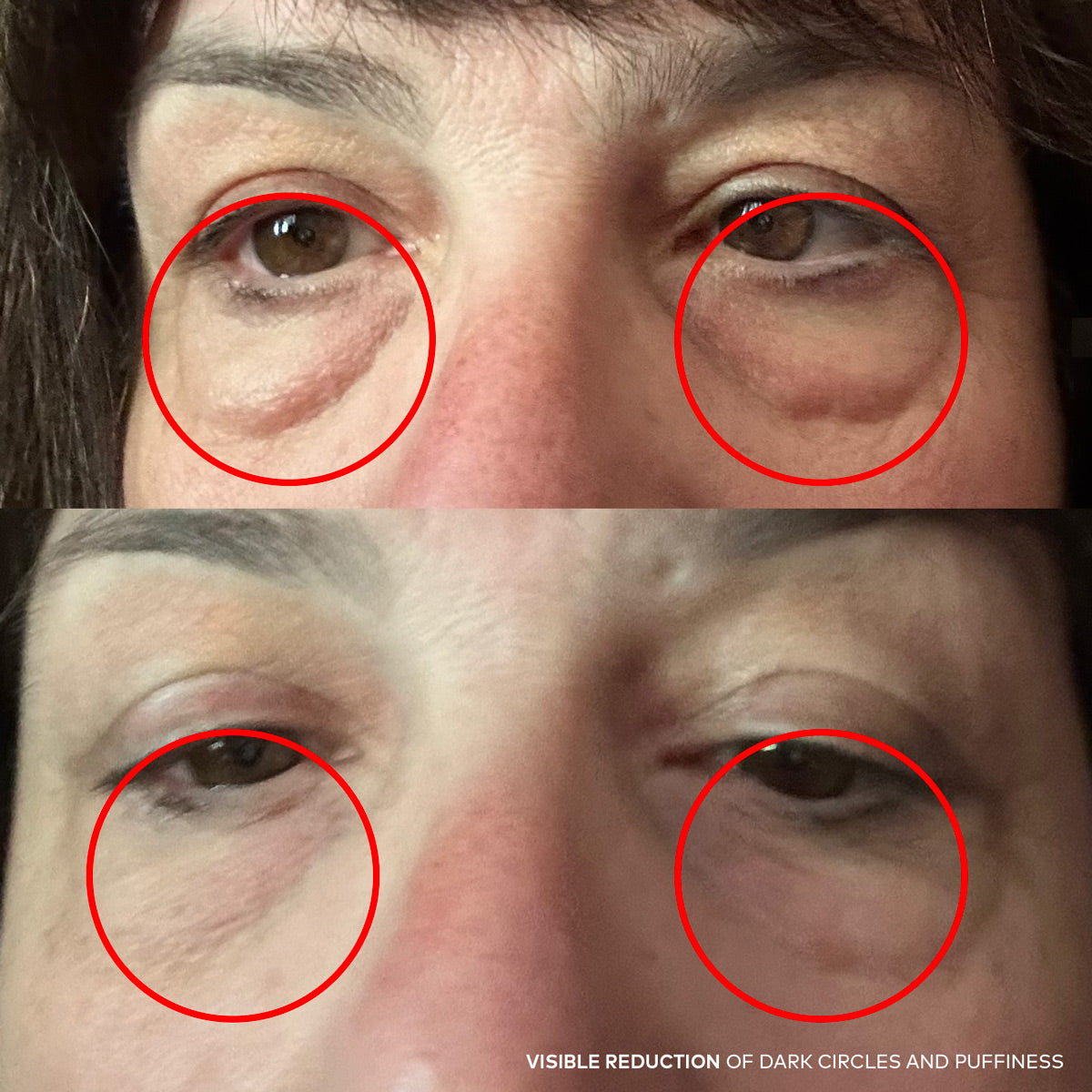 Radical Repair® Ultra Brightening Eye Balm — results | Onekind